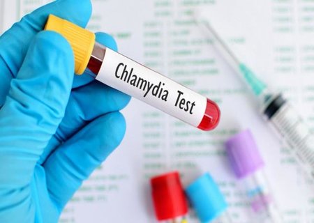 Test nhanh chlamydia
