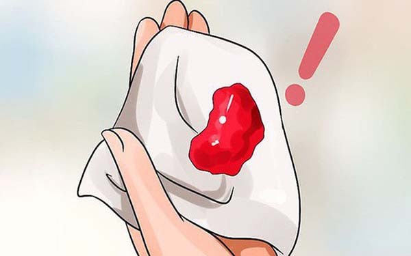 Chớ coi thường chảy máu sau khi quan hệ ở nữ giới