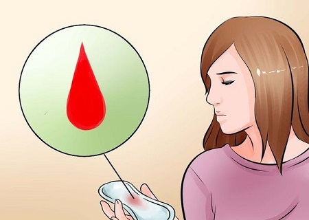 Khí hư có máu là bị bệnh gì?    