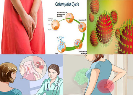 Nhiễm chlamydia là gì? Những điều có thể bạn chưa biết